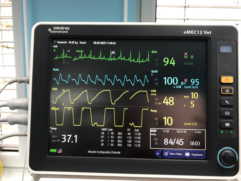 Bild 3 Kapnographie mit erhoehtem FiCO2